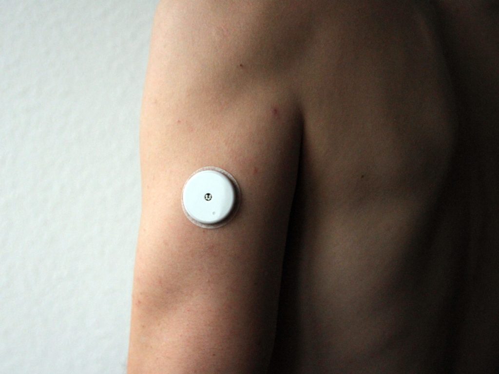 Supersapiens Glucose Sensor am Arm